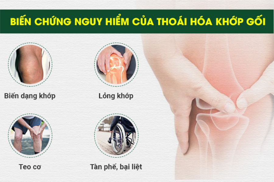 4. Biện pháp phòng ngừa thoái hóa khớp gối